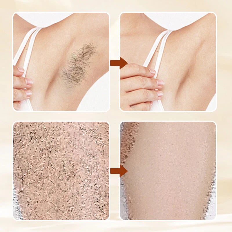 🌸🪒Versatile Aromatic  Hair Removal Cream💁‍♀️✨